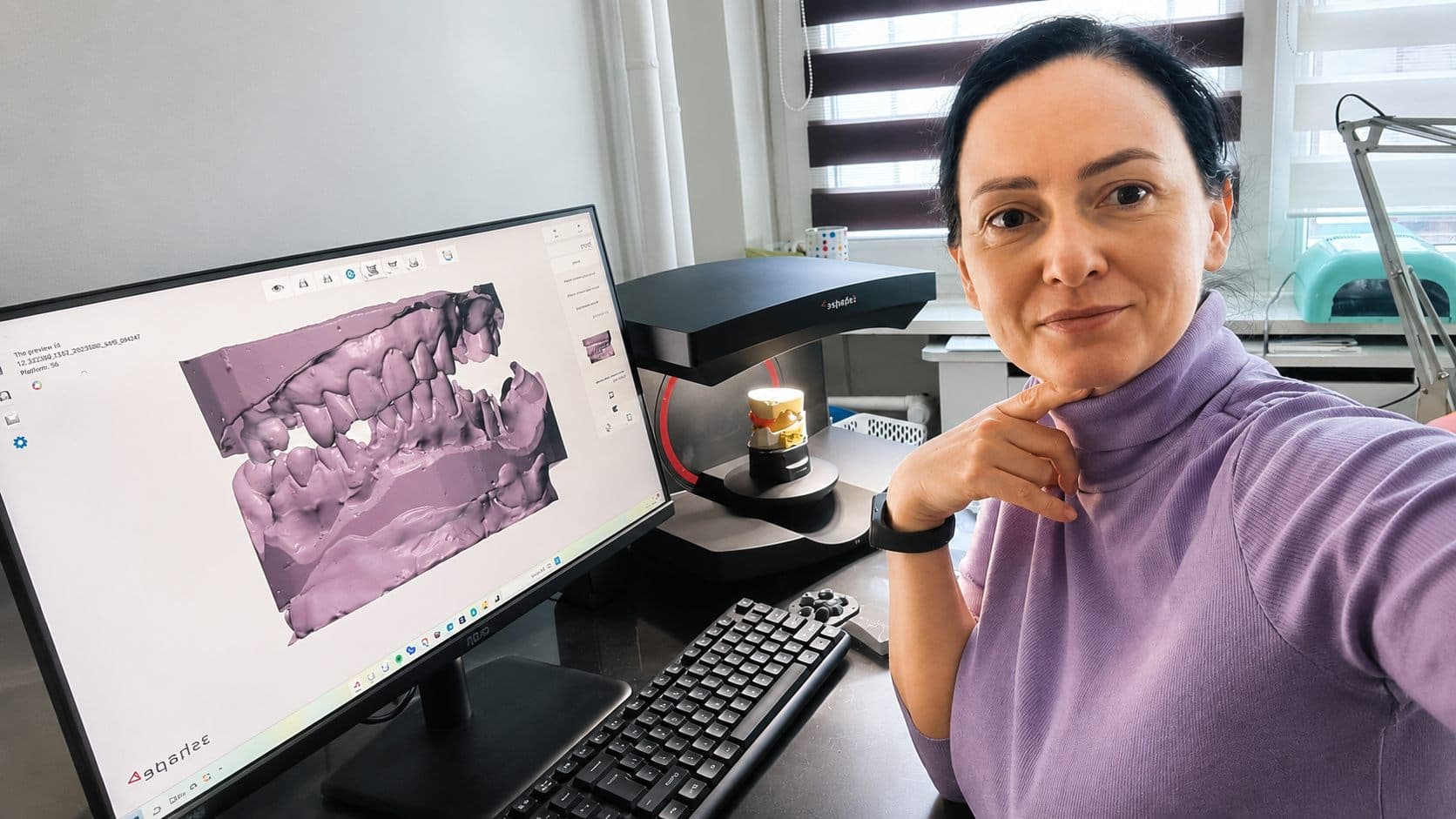 Cyfrowy model 3D na monitorze w pracowni protetycznej Magic Dent